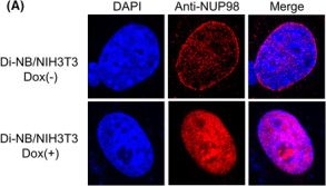 Fig.2.A showing Immunocytochemistry-immunofluorescence in a Homo sapiens (Human) sample from the publication: NUP98-BPTF promotes oncogenic transformation through PIM1 upregulation.