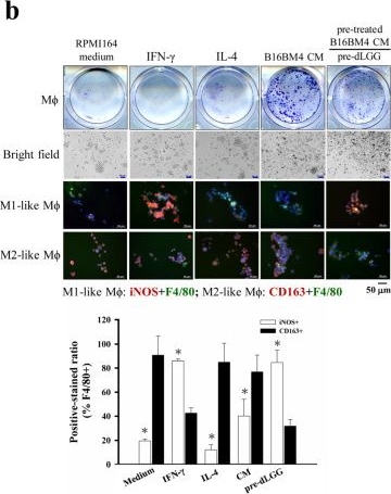 Fig.5.B from the publication: Phytogalactolipid dLGG Inhibits Mouse Melanoma Brain Metastasis through Regulating Oxylipin Activity and Re-Programming Macrophage Polarity in the Tumor Microenvironment.
