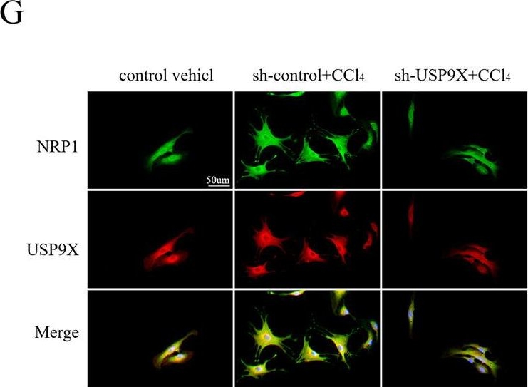 Fig.6.G showing Immunocytochemistry-immunofluorescence in a Mus musculus (House mouse) sample from the publication: USP9X-mediated NRP1 deubiquitination promotes liver fibrosis by activating hepatic stellate cells.