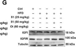 Fig.5.G showing Western Blotting from the publication: N-salicyloyl tryptamine derivative ameliorates spermatogenic dysfunction in obese mice by attenuating insulin resistance, enhancing Sertoli cell glycolysis, and inhibiting apoptosis: an in vivo and in vitro study.