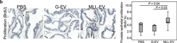 Fig.3.B showing Immunohistochemistry in a Rattus norvegicus (Rat) sample from the publication: Extracellular Vesicles from Metastatic Rat Prostate Tumors Prime the Normal Prostate Tissue to Facilitate Tumor Growth.