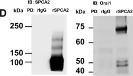 Fig.1.D showing Western Blotting in a Mus musculus (House mouse) sample from the publication: SPCA2 regulates Orai1 trafficking and store independent Ca2+ entry in a model of lactation.