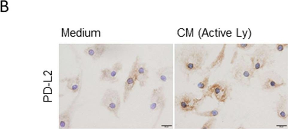 Fig.4.B showing Immunohistochemistry from the publication: GM-CSF derived from the inflammatory microenvironment potentially enhanced PD-L1 expression on tumor-associated macrophages in human breast cancer.