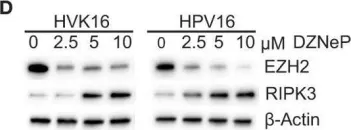 Fig.4.D showing Western Blotting from the publication: Human Papillomavirus Downregulates the Expression of IFITM1 and RIPK3 to Escape from IFNγ- and TNFα-Mediated Antiproliferative Effects and Necroptosis.