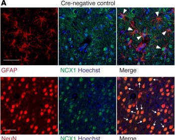 Fig.1.A showing Immunohistochemistry-immunofluorescence in a Mus musculus (House mouse) sample from the publication: Neuronal and astrocytic sodium-calcium exchanger differentially regulates calcium and sodium overload during ischemic stroke.