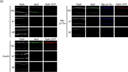 Fig.4.A showing Immunocytochemistry-immunofluorescence from the publication: Involvement of the protein kinase Akt2 in insulin-stimulated Rac1 activation leading to glucose uptake in mouse skeletal muscle.
