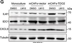 Fig.4.G showing Western Blotting from the publication: IL4I1⁺ Macrophages and TDO2⁺ Myofibroblasts Drive AhR-Mediated Immunosuppression and Ferroptosis Resistance in Solid Predominant Lung Adenocarcinoma.