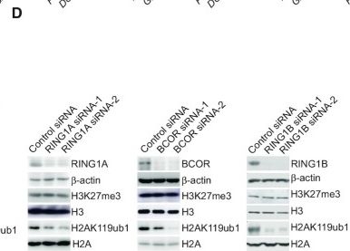 Fig.5.D showing Western Blotting in a Rattus norvegicus (Rat) sample from the publication: Bimodal regulation of the PRC2 complex by USP7 underlies tumorigenesis.
