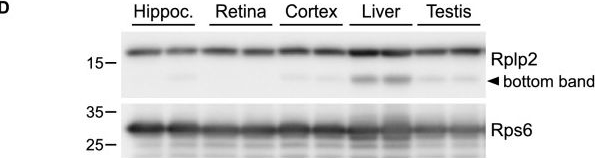 Fig.5.D showing Western Blotting from the publication: Proteomics-based characterization of ribosome heterogeneity in adult mouse organs.