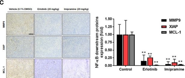 Fig.6.C showing Immunohistochemistry in a Mus musculus (House mouse) sample from the publication: Suppression of EGFR/PKC-δ/NF-κB Signaling Associated With Imipramine-Inhibited Progression of Non-Small Cell Lung Cancer.