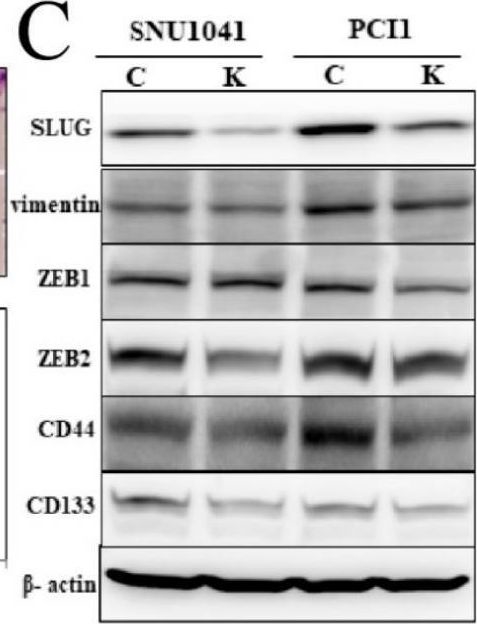 Fig.5.C showing Western Blotting from the publication: Expression of Keratin-1 Predicts Recurrence and Treatment Response in Advanced Laryngeal Cancer: A Potential Therapeutic Target.