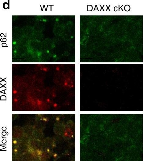 Cytoplasmic DAXX drives SQSTM1/p62 phase condensation to activate Nrf2-mediated stress response.