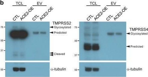 Fig.1.B showing Western Blotting in a Chlorocebus sabaeus (Green monkey) sample from the publication: ACE2-enriched extracellular vesicles enhance infectivity of live SARS-CoV-2 virus.