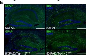 Fig.7.E showing Immunohistochemistry-immunofluorescence from the publication: Amyloid Plaques Ameliorate Memory Deficits and Hippocampal Neuron Loss in an Aβ4-42-Driven Alzheimer's Disease Mouse Model.