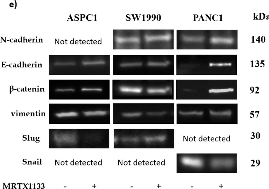 Fig.4.E showing Western Blotting in a Homo sapiens (Human) sample from the publication: Antimetastatic effects of MRTX1133 KRAS G12D specific inhibitor in a liver metastatic model of pancreatic ductal adenocarcinoma.