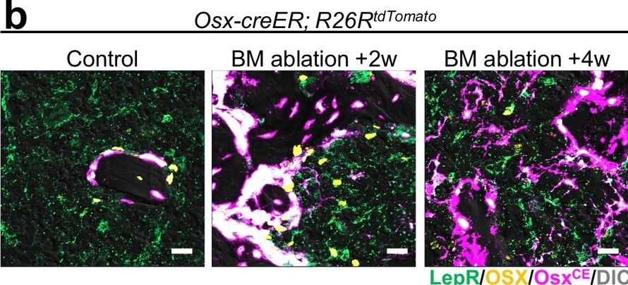 Fig.4.B showing Immunohistochemistry-immunofluorescence in a Spider sample from the publication: Injury-driven stromal exhaustion disrupts intrinsic regenerative capability.
