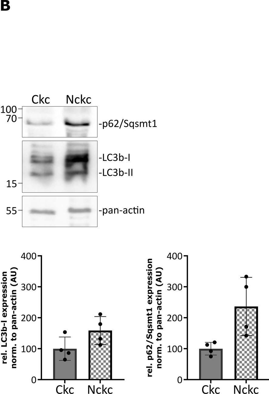 Primary cilia suppress Ripk3-mediated necroptosis.