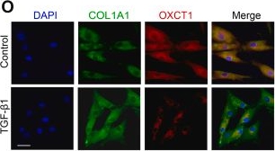 Fig.2.O showing Immunocytochemistry-immunofluorescence from the publication: Acetoacetate ameliorates skin fibrosis by modulating TGF-β1-Smad2/3 signaling pathway.