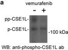 Fig.2.A showing Western Blotting in a Mus musculus (House mouse) sample from the publication: Early decline in serum phospho-CSE1L levels in vemurafenib/sunitinib-treated melanoma and sorafenib/lapatinib-treated colorectal tumor xenografts.