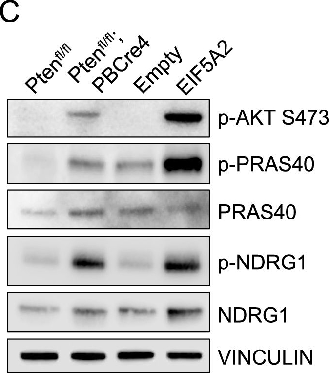 Fig.5.C showing Western Blotting from the publication: Identification of genes that promote PI3K pathway activation and prostate tumour formation.