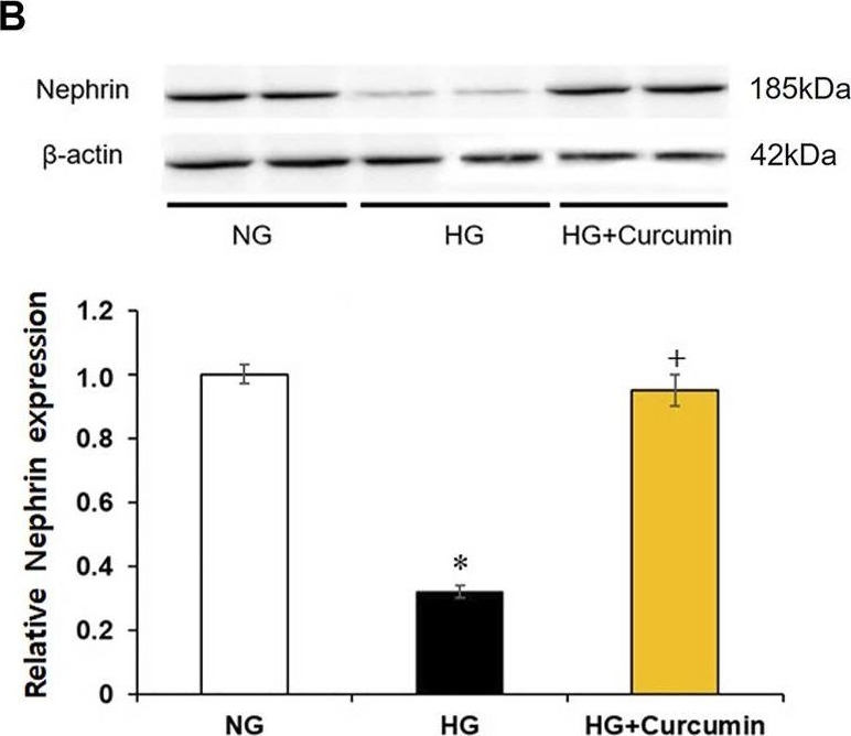 Curcumin Blocks High Glucose-Induced Podocyte Injury via RIPK3-Dependent Pathway.