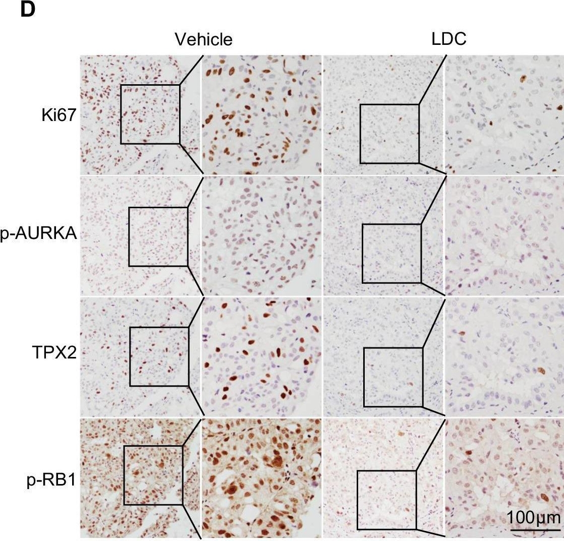 Fig.5.D showing Immunohistochemistry in a Homo sapiens (Human) sample from the publication: Comprehensive molecular characterization of collecting duct carcinoma for therapeutic vulnerability.