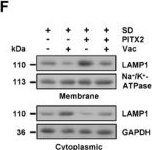Fig.2.F showing Western Blotting in a Homo sapiens (Human) sample from the publication: Nortriptyline Inhibits Lysosomal Exocytosis-Mediated SASP During Gastric Cancer Progression via Targeting HOXA1-PITX2 Phase Separation.