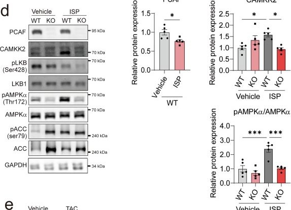 Fig.5.D showing Western Blotting from the publication: Loss of p300/CBP-associated factor aggravates cardiac remodeling via regulation of CAMKK2 acetylation.