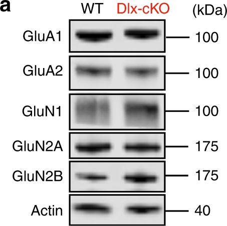 Fig.4.A showing Western Blotting in a Mus musculus (House mouse) sample from the publication: Altered NMDAR signaling underlies autistic-like features in mouse models of CDKL5 deficiency disorder.