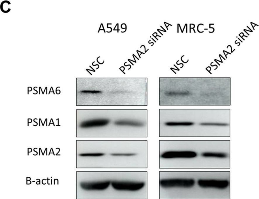 Fig.6.C showing Western Blotting from the publication: Influenza A Virus Uses PSMA2 for Downregulation of the NRF2-Mediated Oxidative Stress Response.