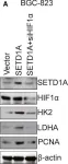 Fig.5.A showing Western Blotting from the publication: Histone methyltransferase SETD1A interacts with HIF1α to enhance glycolysis and promote cancer progression in gastric cancer.