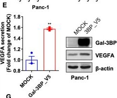 Fig.2.E showing Western Blotting in a Homo sapiens (Human) sample from the publication: The Galectin-3-binding protein promotes angiogenesis in pancreatic cancer via simultaneous upregulation of VEGFA and direct HUVEC activation mediated by and VAMP5-STAT3.