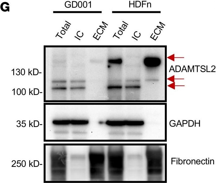 Fig.1.G showing Western Blotting in a Homo sapiens (Human) sample from the publication: ADAMTSL2 mutations determine the phenotypic severity in geleophysic dysplasia.