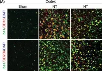 Fig.4.A showing Immunohistochemistry-immunofluorescence in a Mus musculus (House mouse) sample from the publication: Selective brain hypothermia attenuates focal cerebral ischemic injury and improves long-term neurological outcome in aged female mice.