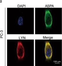 Fig.6.G showing Immunocytochemistry-immunofluorescence from the publication: Aspartoacylase suppresses prostate cancer progression by blocking LYN activation.