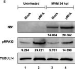 Phospho-RPA32/RPA2 (Ser8) Antibody | Cell Signaling Technology