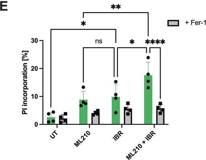Fig.3.E from the publication: Redox destabilization by ibrutinib promotes ferroptosis in diffuse large B-cell lymphoma (DLBCL).