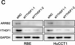 Fig.5.C showing Western Blotting from the publication: N6-methyladenosine-mediated up-regulation of ARRB2 regulates intrahepatic cholangiocarcinoma malignant progression and pemigatinib resistance through MAPK and Hippo signaling pathways.