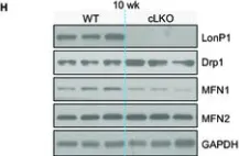 Fig.2.H showing Western Blotting from the publication: LonP1 Links Mitochondria-ER Interaction to Regulate Heart Function.