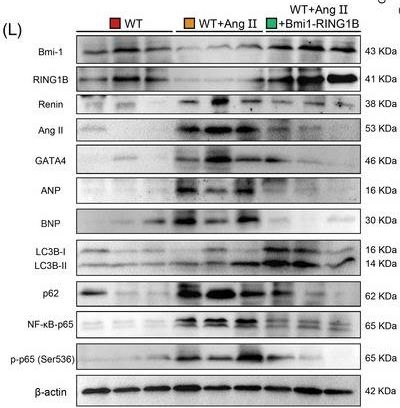 Fig.8.L showing Western Blotting from the publication: Bmi-1-RING1B prevents GATA4-dependent senescence-associated pathological cardiac hypertrophy by promoting autophagic degradation of GATA4.