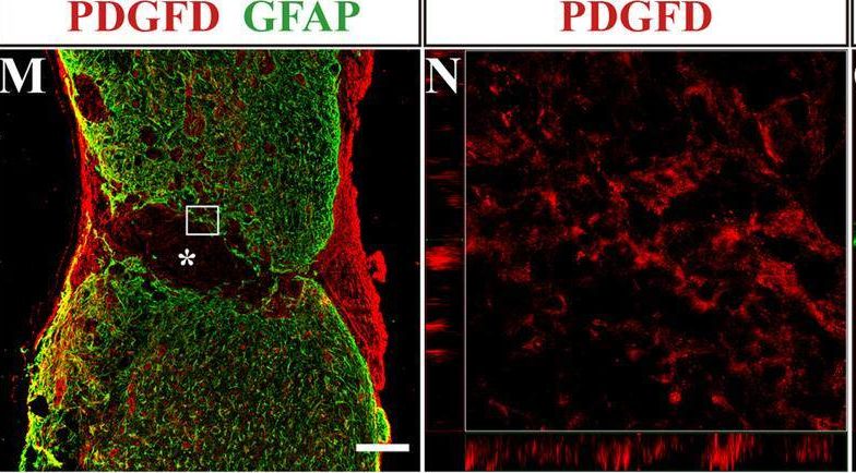 Fig.4.V showing Immunohistochemistry-immunofluorescence from the publication: SU16f inhibits fibrotic scar formation and facilitates axon regeneration and locomotor function recovery after spinal cord injury by blocking the PDGFRβ pathway.