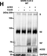 Fig.4.H showing Western Blotting from the publication: Concanavalin A targets phylogenetically conserved N-linked glycans on coronavirus spike proteins for broad-spectrum antiviral activity.