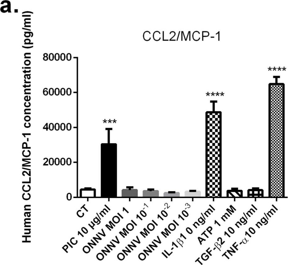 Fig.7.A showing Enzyme-linked immunosorbent assay in a Homo sapiens (Human) sample from the publication: Deciphering the Role of Schwann Cells in Inflammatory Peripheral Neuropathies Post Alphavirus Infection.