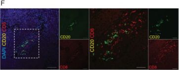 CD8α Antibody (D4W2Z) XP® Rabbit mAb | Cell Signaling Technology