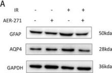 その他 ND3 AQP4 (D1F8E) Rabbit Monoclonal Antibody | Cell Signaling Technology