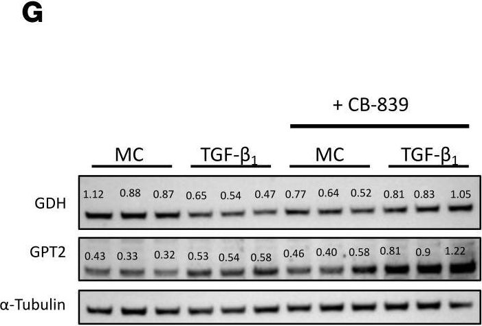Fig.5.G showing Western Blotting from the publication: Pyruvate metabolism dictates fibroblast sensitivity to GLS1 inhibition during fibrogenesis.