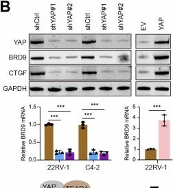 Fig.3.B showing Western Blotting in an Armoracia rusticana (Horseradish) sample from the publication: Aberrant activation of epigenetic BRD9-DGAT1 axis promotes lipid droplets deposition and ferroptosis resistance in YAP-high prostate cancer.