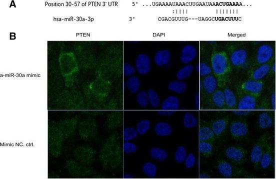 Fig.3.A showing Immunocytochemistry-immunofluorescence in a Homo sapiens (Human) sample from the publication: Bioinformatics prediction of miR-30a targets and its inhibition of cell proliferation of osteosarcoma by up-regulating the expression of PTEN.