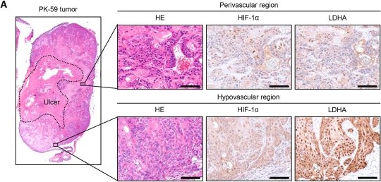 Fig.5.A showing Immunohistochemistry from the publication: Mitochondrial inhibition enhances the sensitivity of pancreatic ductal adenocarcinoma cells to oncolytic adenovirus.