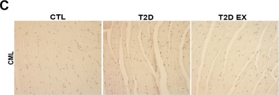 Fig.1.C showing Immunohistochemistry in a Mus musculus (House mouse) sample from the publication: Aerobic exercise training attenuates cardiac inflammation and fibrosis in mice with type 2 diabetes and inhibits the advanced glycation end products pathway.